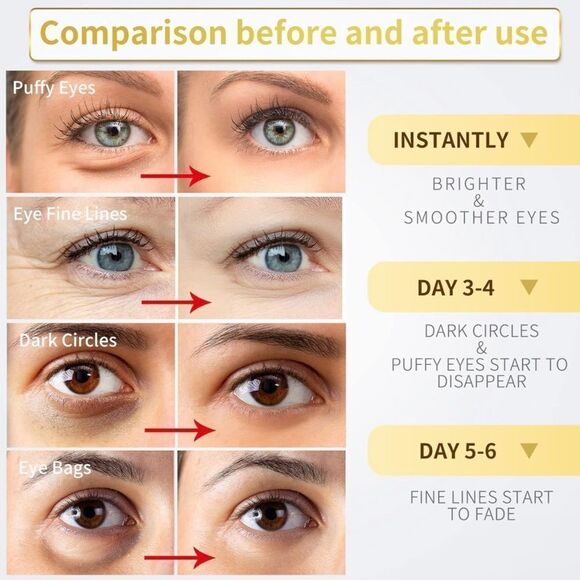 Under Eye Patches-60 Pcs-24K Gold Eye Mask- Puffy Eyes & Dark Circles Treatments - Picture 5 of 7